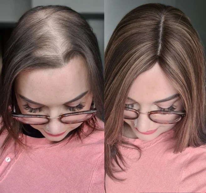 Pros and Cons of Silk Toppers